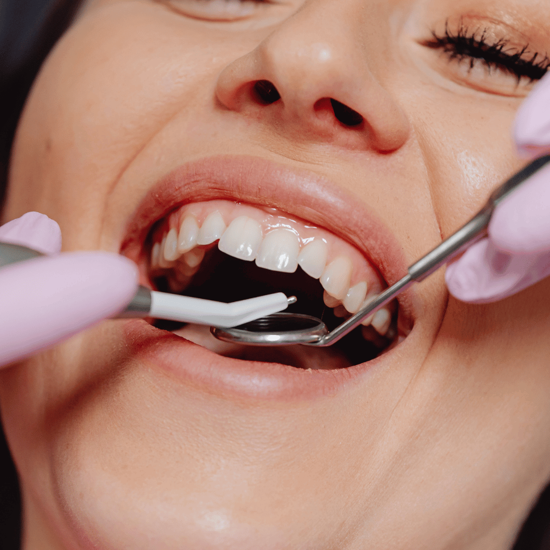 Dentística e restauração dental — X-Dent São Carlos